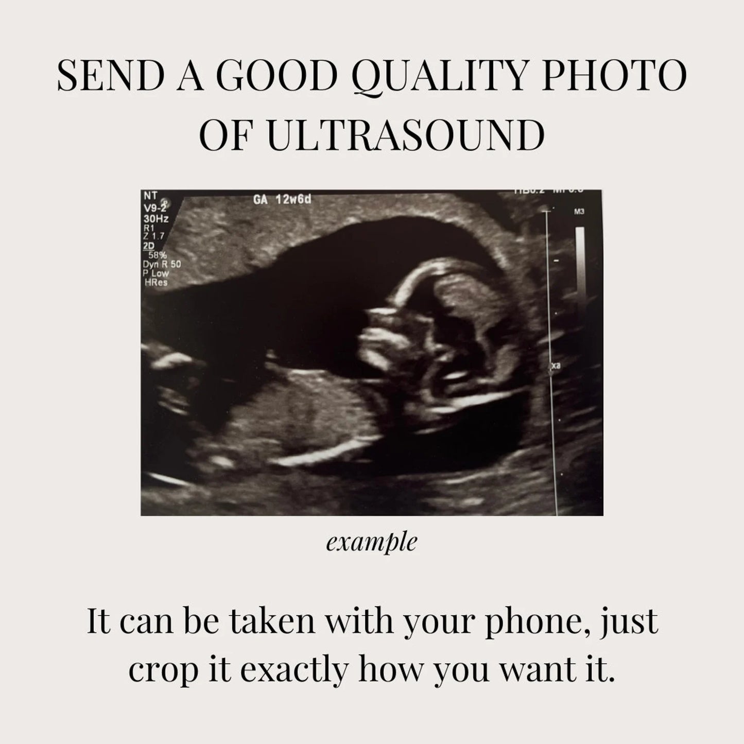 Ultrasound Confetti Favors / Baby Shower Confetti